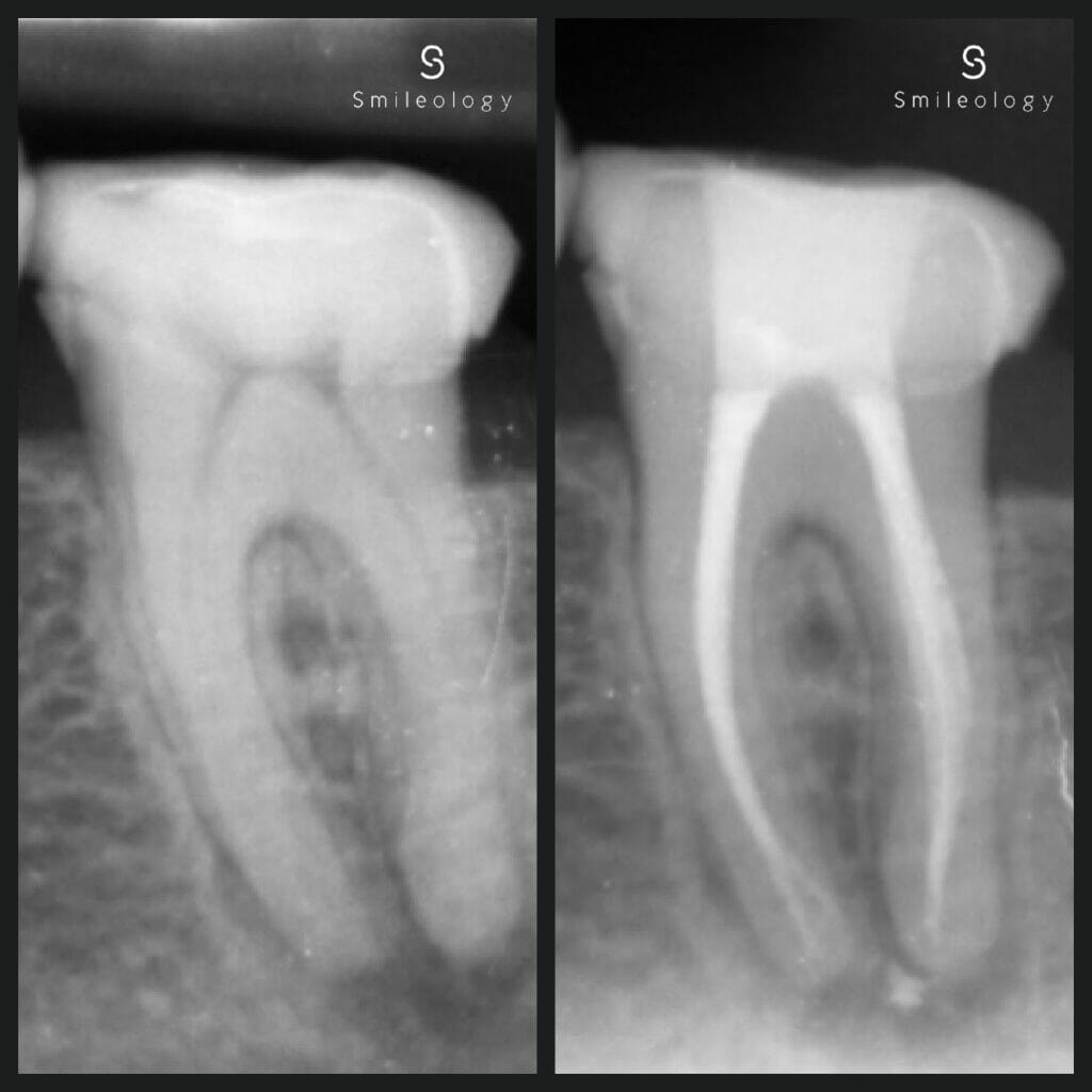 Best dentist in the area ? Smileology Oral Health Dental Clinic Dentist Invisalign Dentist near me Dental implant Dr. Shah Dr. Behzad