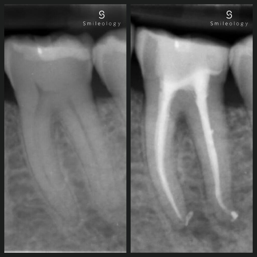 Best dentist in the area ? Smileology Oral Health Dental Clinic Dentist Invisalign Dentist near me Dental implant Dr. Shah Dr. Behzad