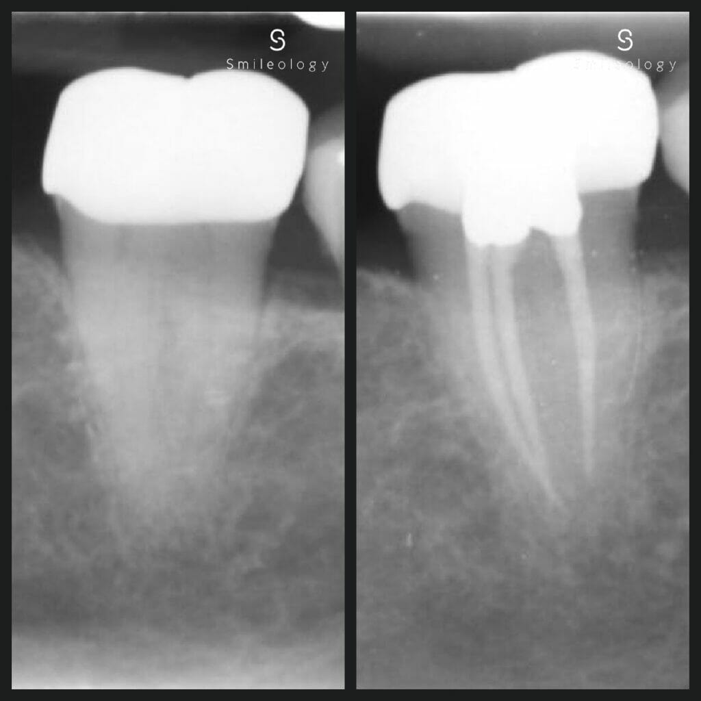 Best dentist in the area ? Smileology Oral Health Dental Clinic Dentist Invisalign Dentist near me Dental implant Dr. Shah Dr. Behzad