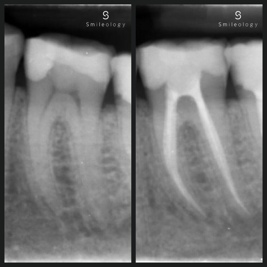 Best dentist in the area ? Smileology Oral Health Dental Clinic Dentist Invisalign Dentist near me Dental implant Dr. Shah Dr. Behzad