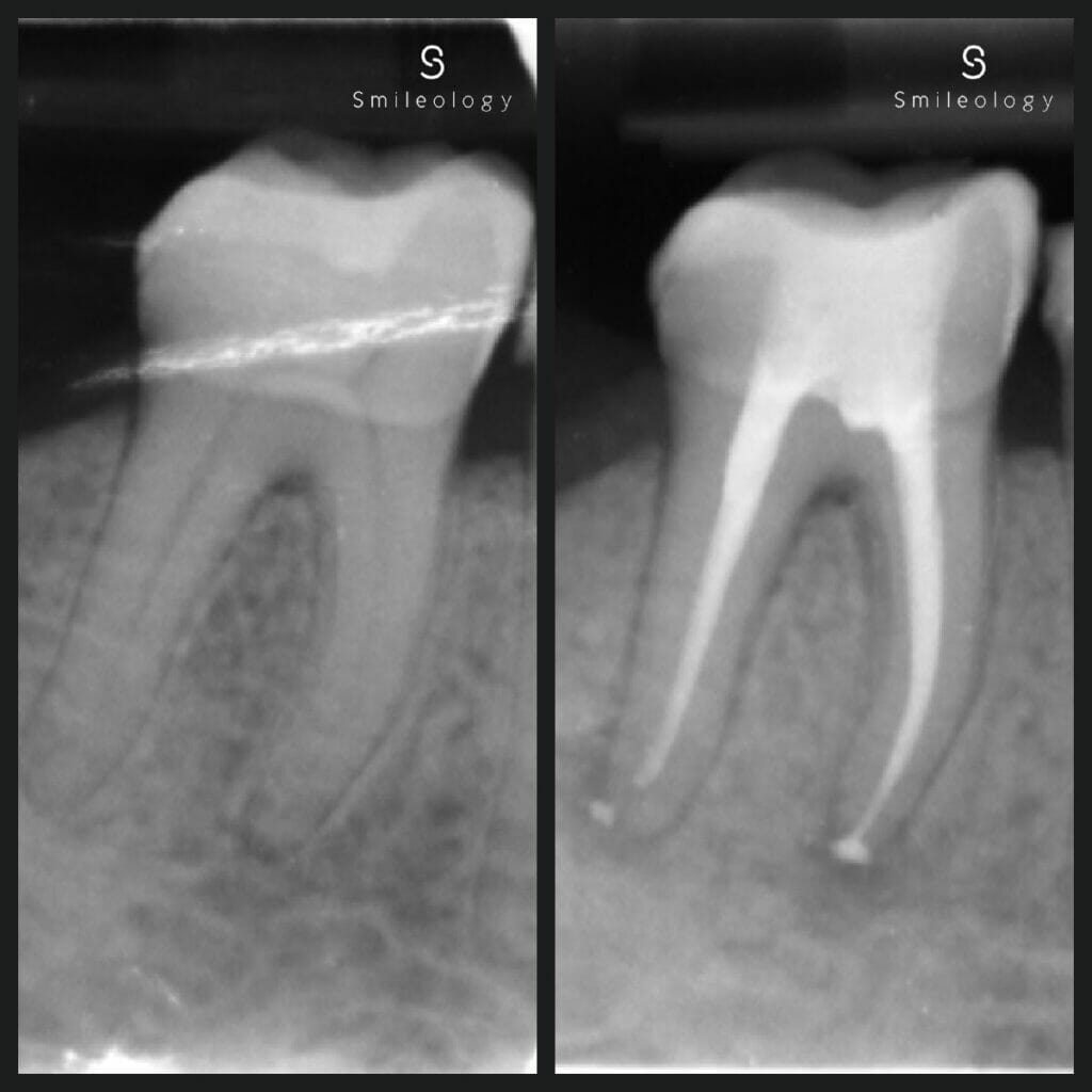 Best dentist in the area ? Smileology Oral Health Dental Clinic Dentist Invisalign Dentist near me Dental implant Dr. Shah Dr. Behzad