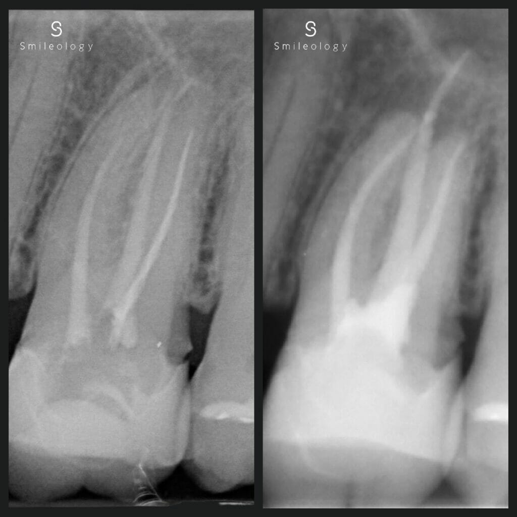 Best dentist in the area ? Smileology Oral Health Dental Clinic Dentist Invisalign Dentist near me Dental implant Dr. Shah Dr. Behzad