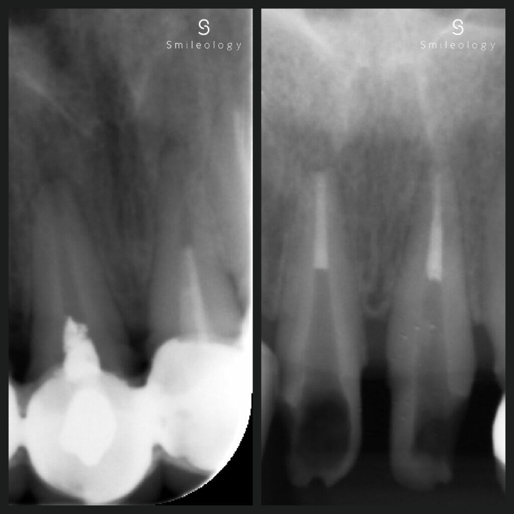 Best dentist in the area ? Smileology Oral Health Dental Clinic Dentist Invisalign Dentist near me Dental implant Dr. Shah Dr. Behzad