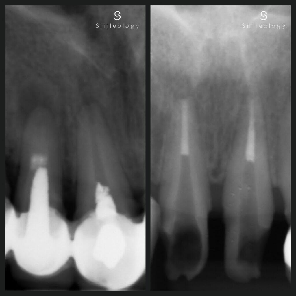 SS Sandher Re RCT copy 2