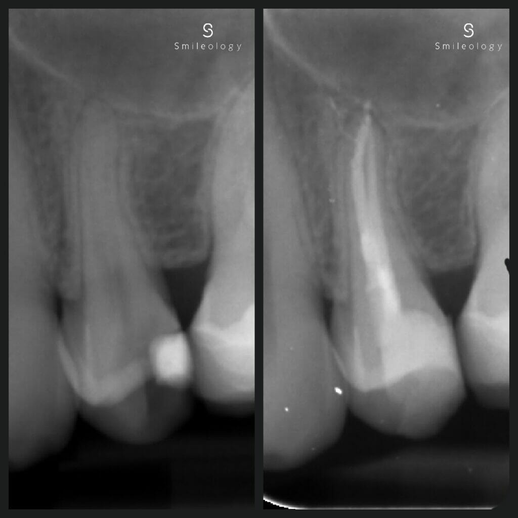 Best dentist in the area ? Smileology Oral Health Dental Clinic Dentist Invisalign Dentist near me Dental implant Dr. Shah Dr. Behzad