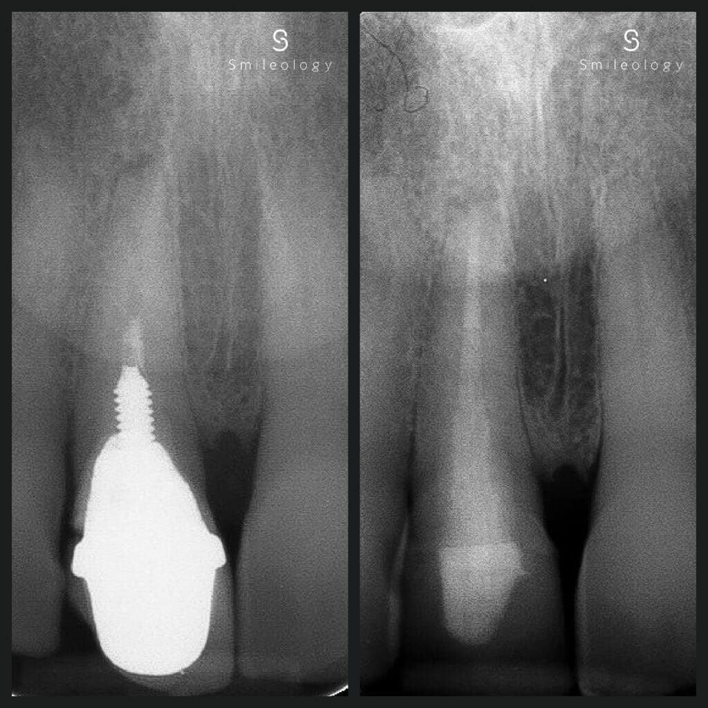 Best dentist in the area ? Smileology Oral Health Dental Clinic Dentist Invisalign Dentist near me Dental implant Dr. Shah Dr. Behzad