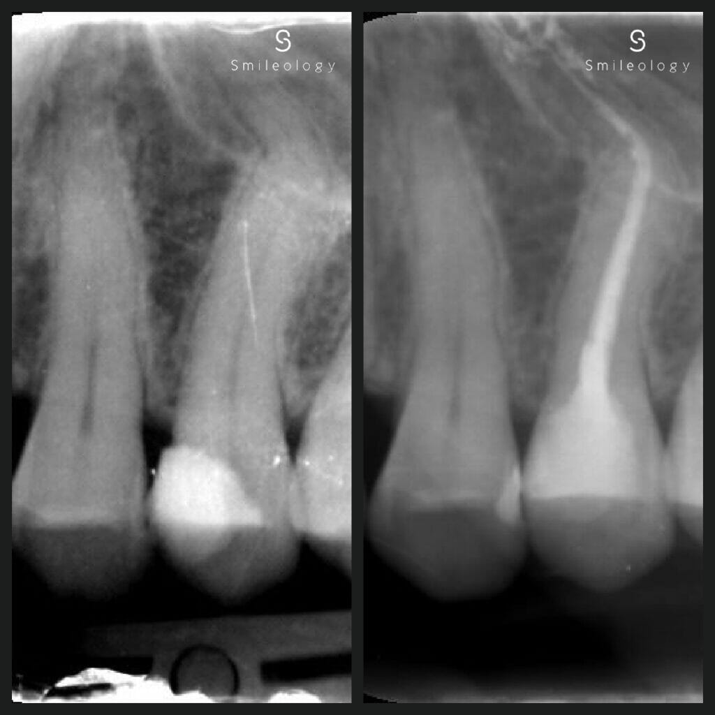 Best dentist in the area ? Smileology Oral Health Dental Clinic Dentist Invisalign Dentist near me Dental implant Dr. Shah Dr. Behzad