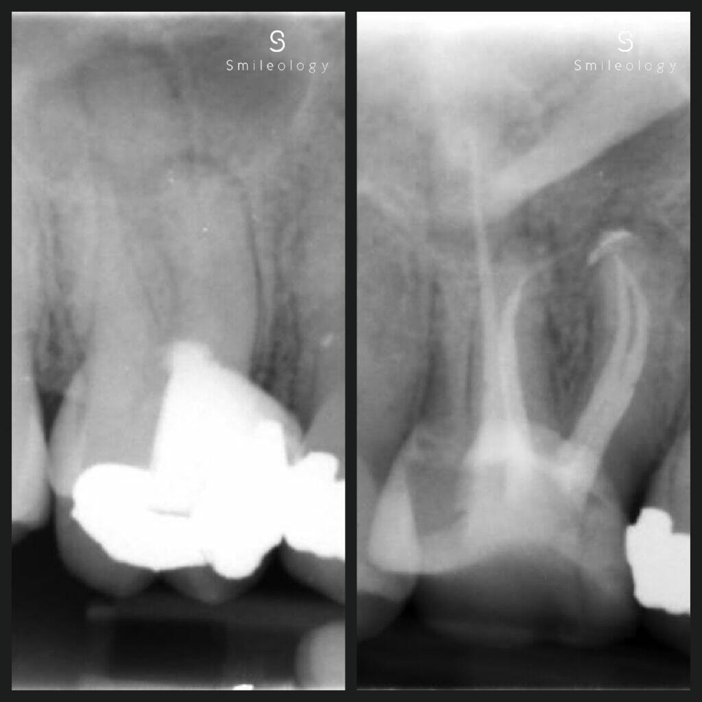 Best dentist in the area ? Smileology Oral Health Dental Clinic Dentist Invisalign Dentist near me Dental implant Dr. Shah Dr. Behzad