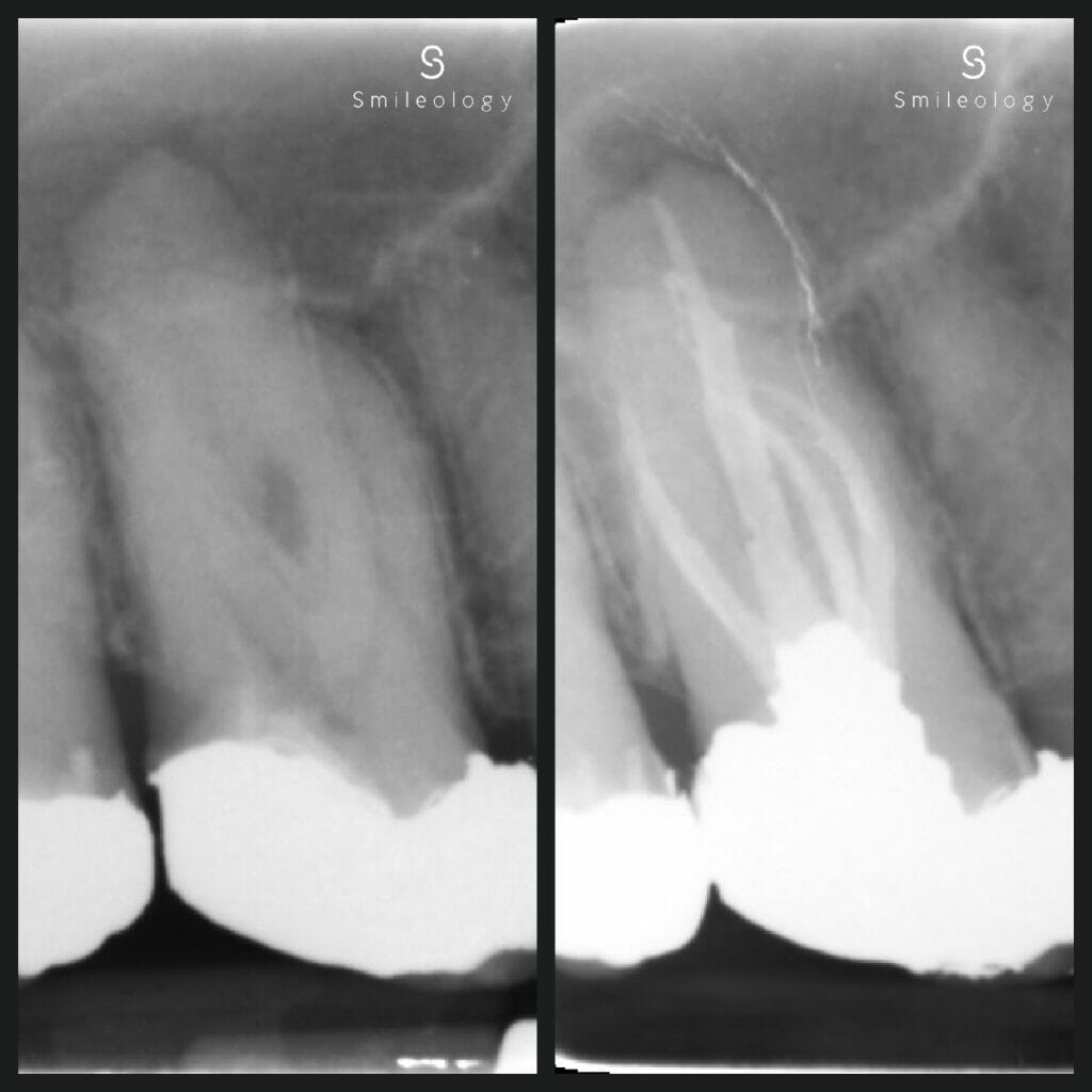 Best dentist in the area ? Smileology Oral Health Dental Clinic Dentist Invisalign Dentist near me Dental implant Dr. Shah Dr. Behzad