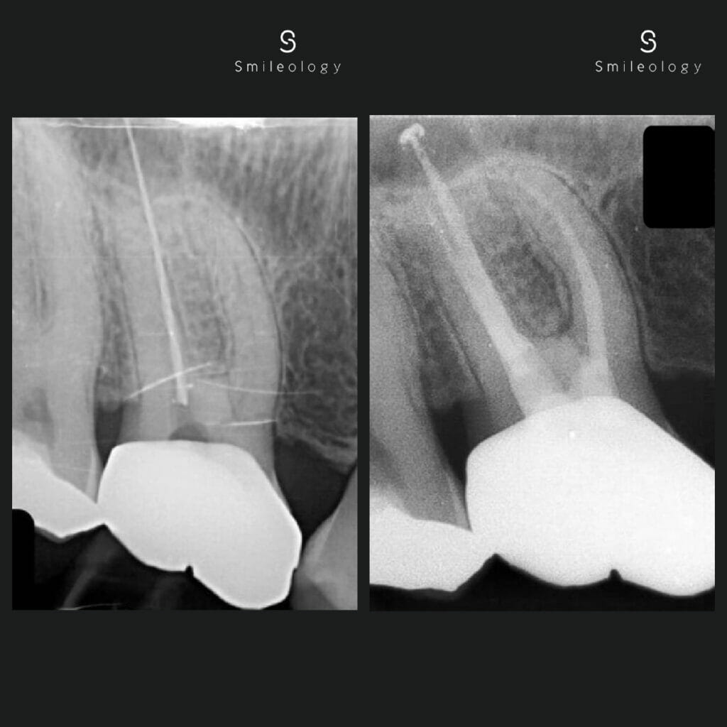 Best dentist in the area ? Smileology Oral Health Dental Clinic Dentist Invisalign Dentist near me Dental implant Dr. Shah Dr. Behzad