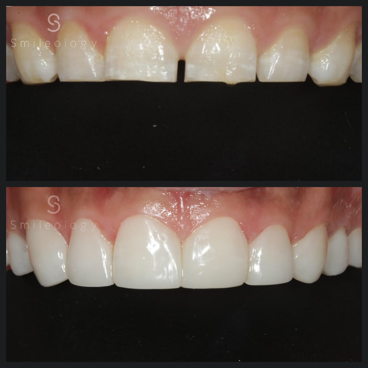 BM cous B&A BDC copy 3