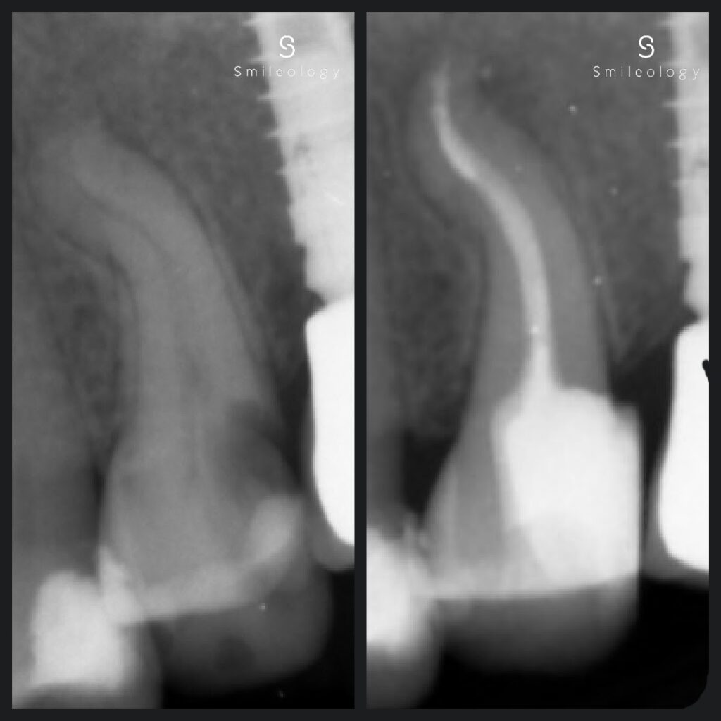 Inman RCT copy