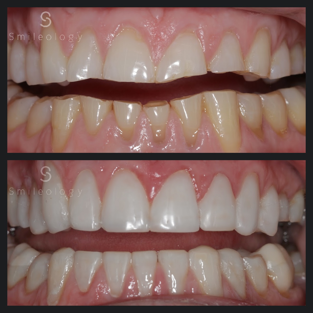 SP B&A TDP