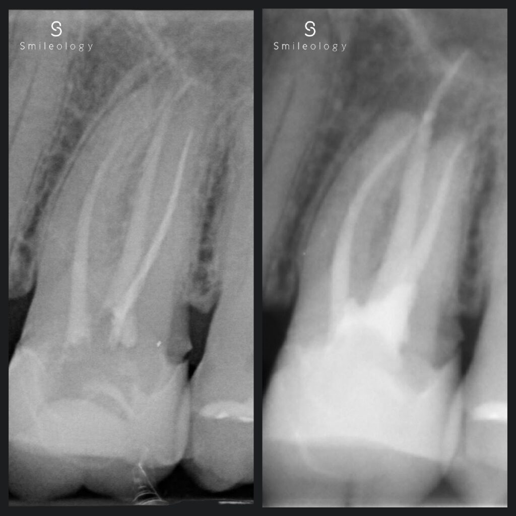 SS Retrieved RCT NJ copy 3